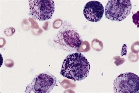 Sudan stain .